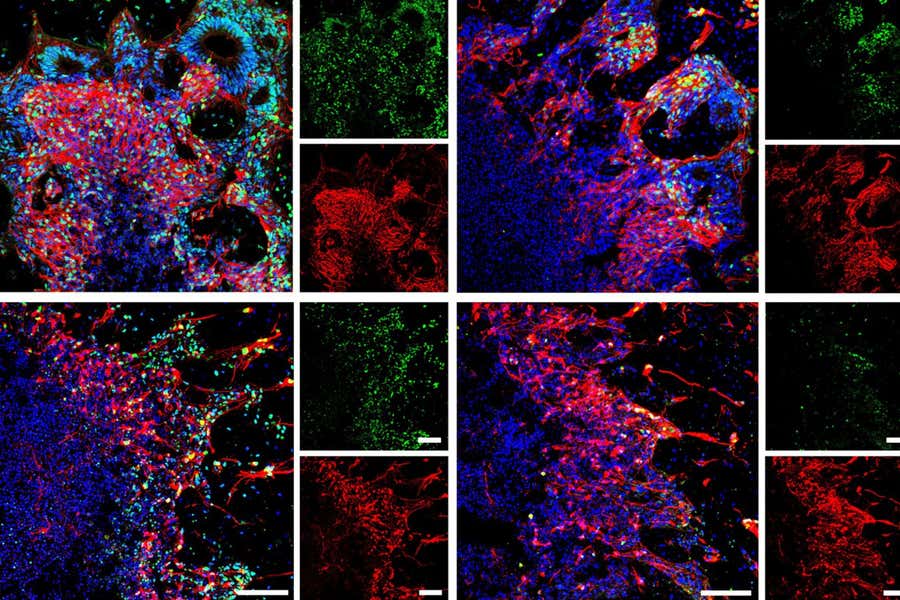 Infranto record criogenico, team rianima tessuto cerebrale dopo 18 mesi Futuro Prossimo
