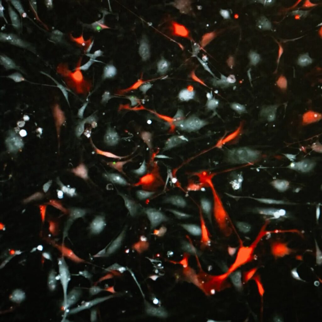 Cellule nasali per riparare il midollo, parte sperimentazione clinica Futuro Prossimo