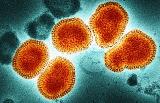 Caccia alla prossima pandemia? Non è inevitabile Futuro Prossimo