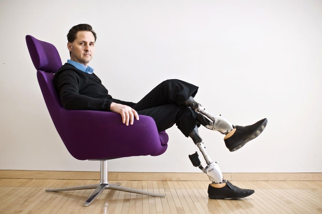Protesi neurali del MIT, un trionfo: addio mesi di riabilitazione Futuro Prossimo