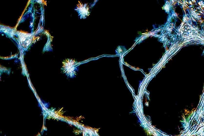 Neurogenesi adulta, conferma: nuovi neuroni anche dopo i 70 anni Futuro Prossimo
