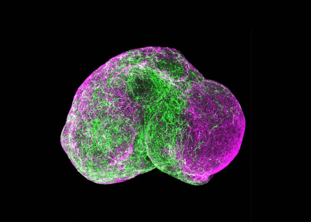 Organoidi, mini cervelli imitano i neuroni infantili: è l’ora dell’etica Futuro Prossimo