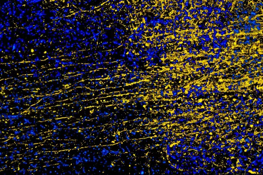 Midollo spinale ricucito con un gel: primo successo per i fusogeni Futuro Prossimo