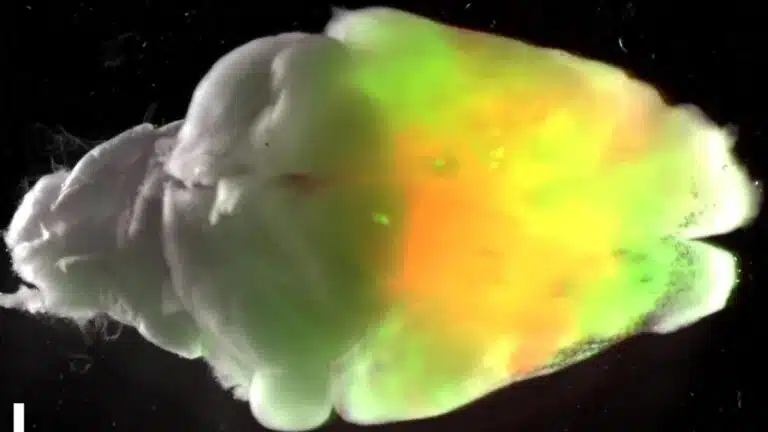 Hanno fatto crescere organoidi cerebrali umani nel cervello dei topi Futuro Prossimo