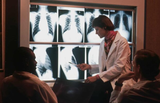 Un farmaco per il cuore potrebbe intercettare il cancro al polmone Futuro Prossimo