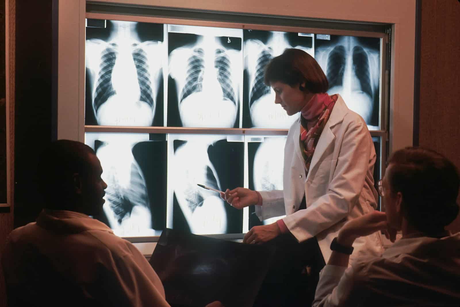 Un farmaco per il cuore potrebbe intercettare il cancro al polmone Futuro Prossimo